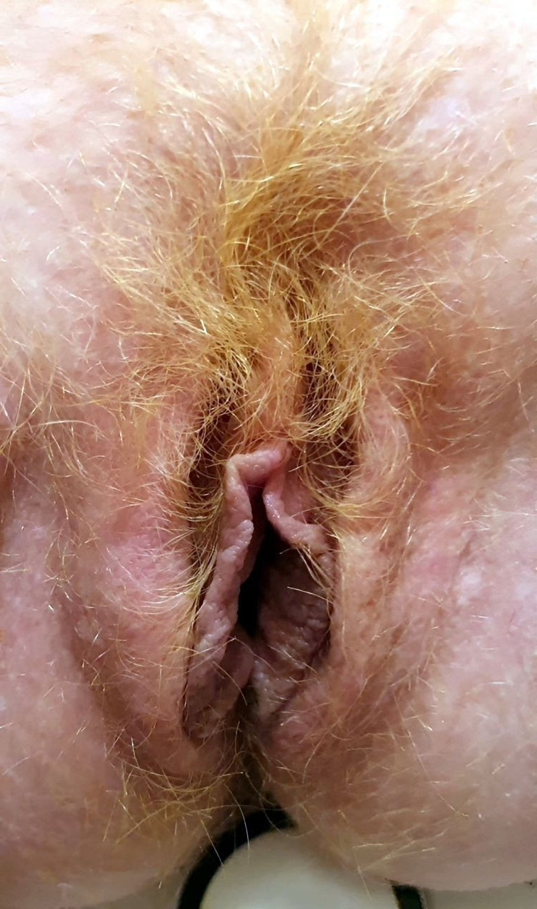 hairy blonde twat xxx pics